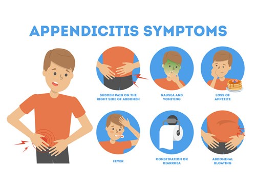 Signs of appendicitis can be mild at first, ranging from loss of appetite and bloating to nausea and a fever. Over time, the pain in the abdomen will get so severe, nothing except surgery will relieve it.