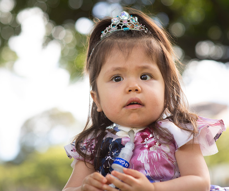 A 2-year-old girl with a breathing device is dressed as a princess and poses for the camera.