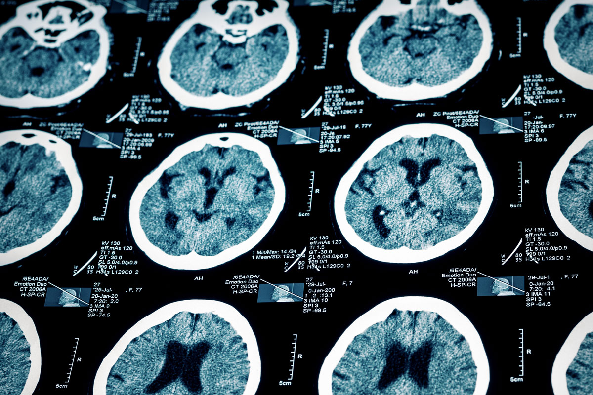 numerous brain scans