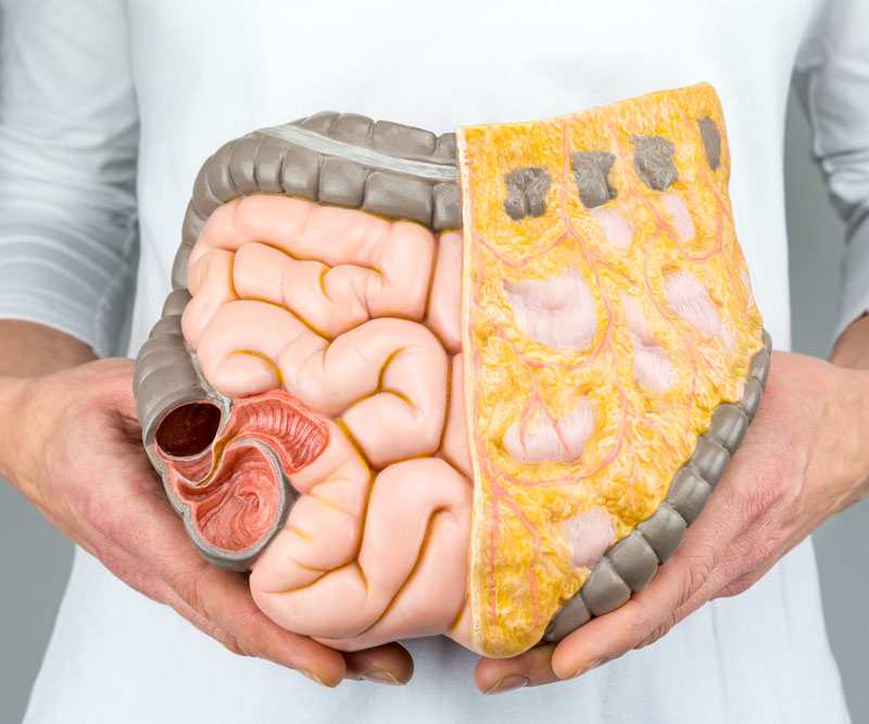 Doctor holding up a model of an intestinal tract