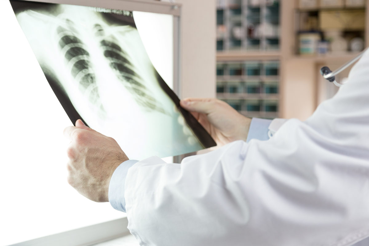 doctor examining x-ray scans of patient