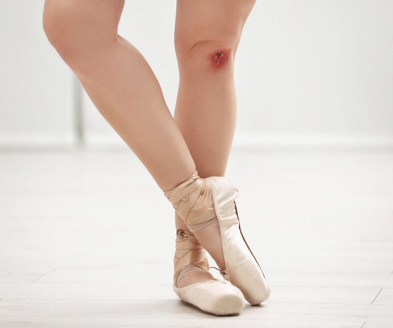 ballerina with a cut on her leg