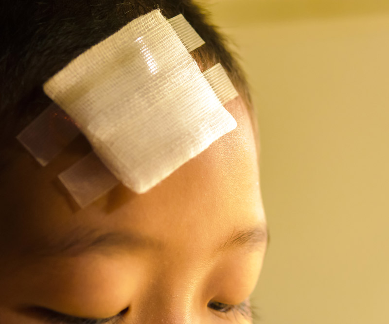 child with a bandage on their forehead