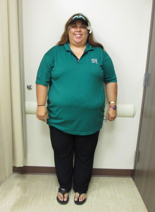 Shelly Kahalelehua-Kahapea before joining the Hawaii Pacific Health 360° Weight Management Center at Pali Momi.