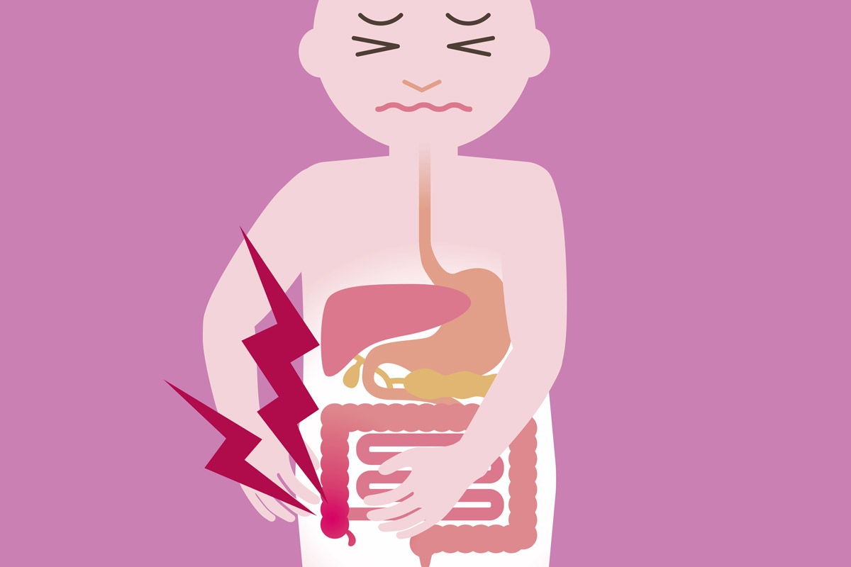 illustration of a person with appendicitis