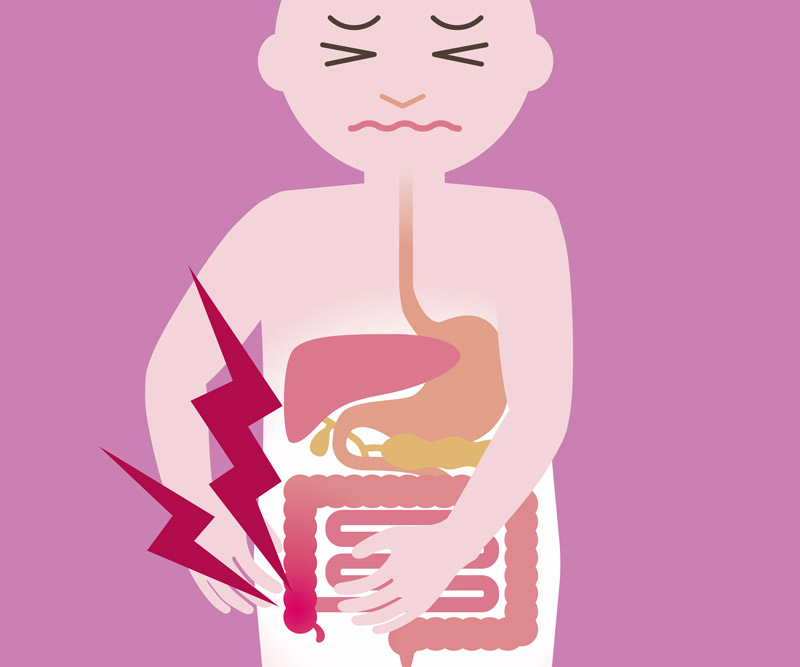 illustration of a person with appendicitis