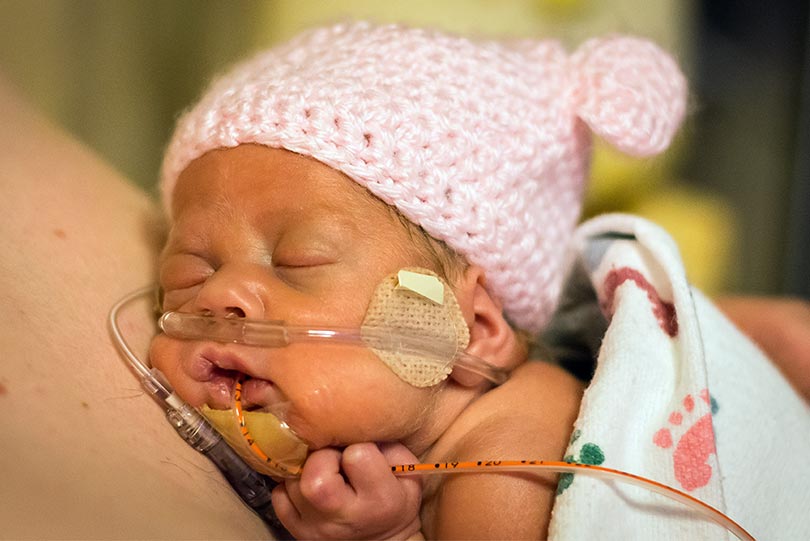 Premature infant girl NICU patient gets skin-on-skin contact with dad.