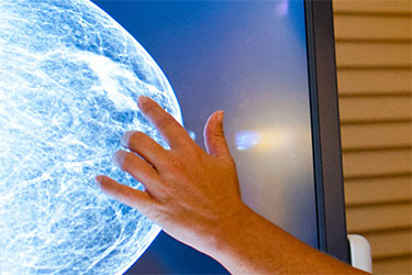 hand pointing at image of breast mammogram