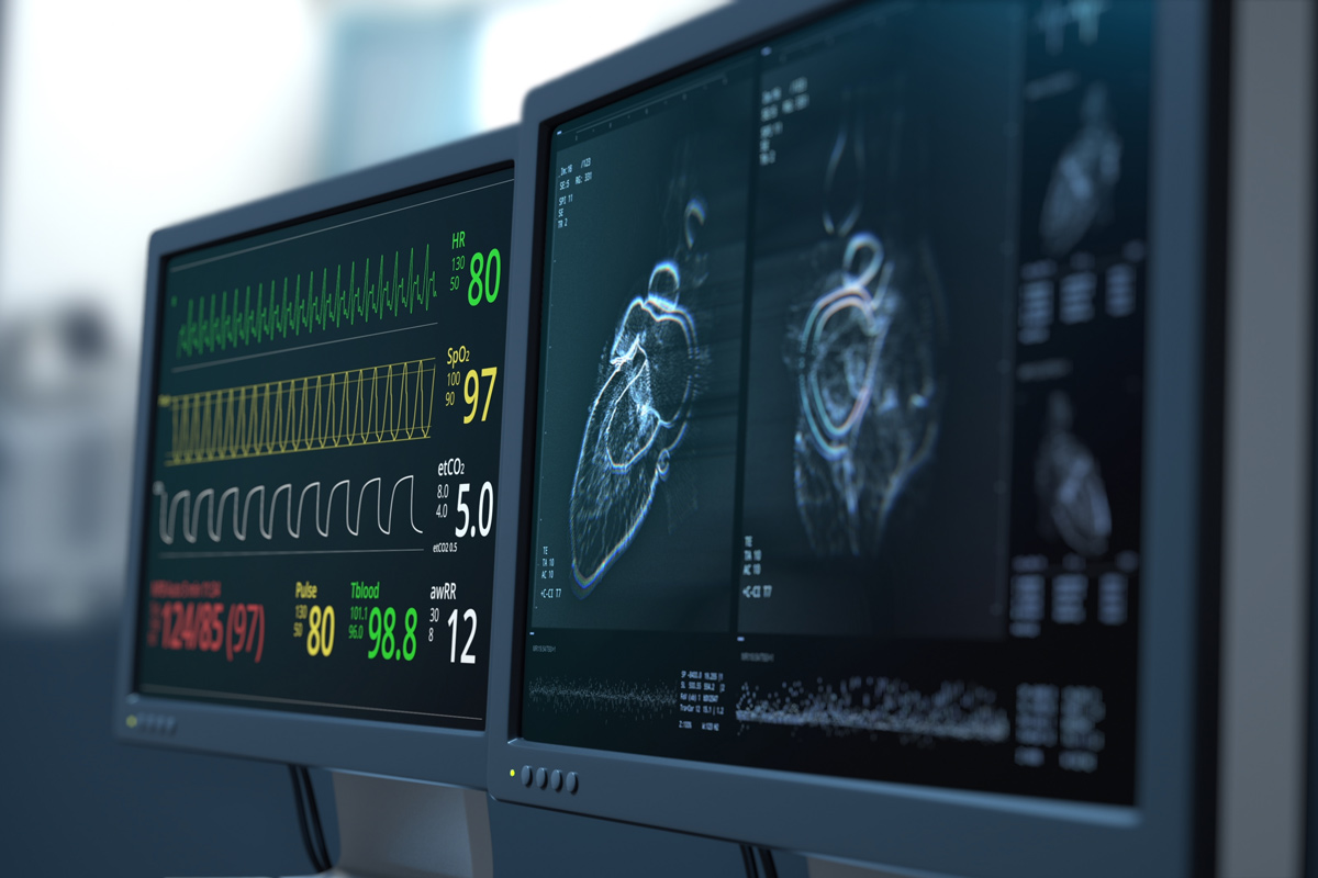 medical monitors display a patient's vital signs and a scan of a heart