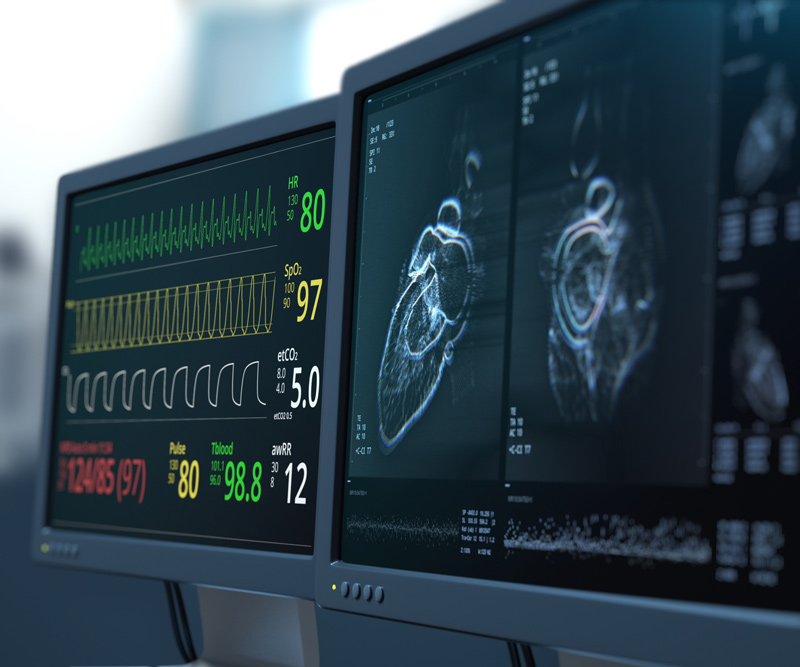 medical monitors display a patient's vital signs and a scan of a heart