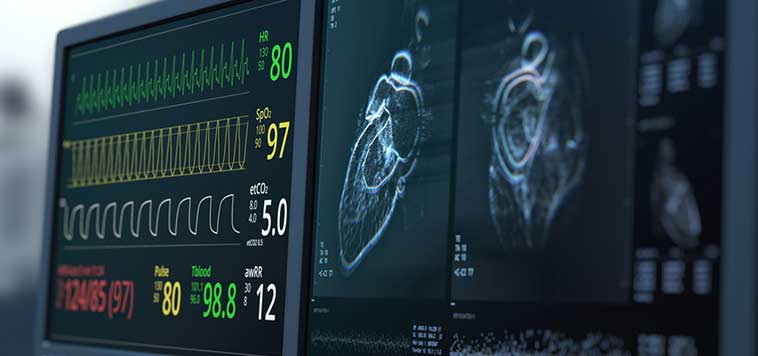 Heart monitor screen and heart imaging.
