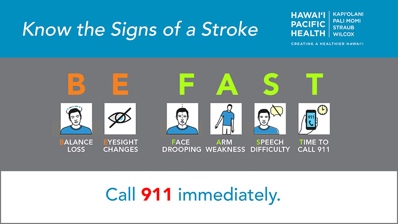Infographic explaining the BE FAST acronym for recognizing stroke symptoms.
