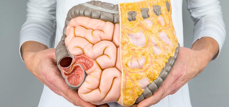 Woman holding an anatomical model of a colon.