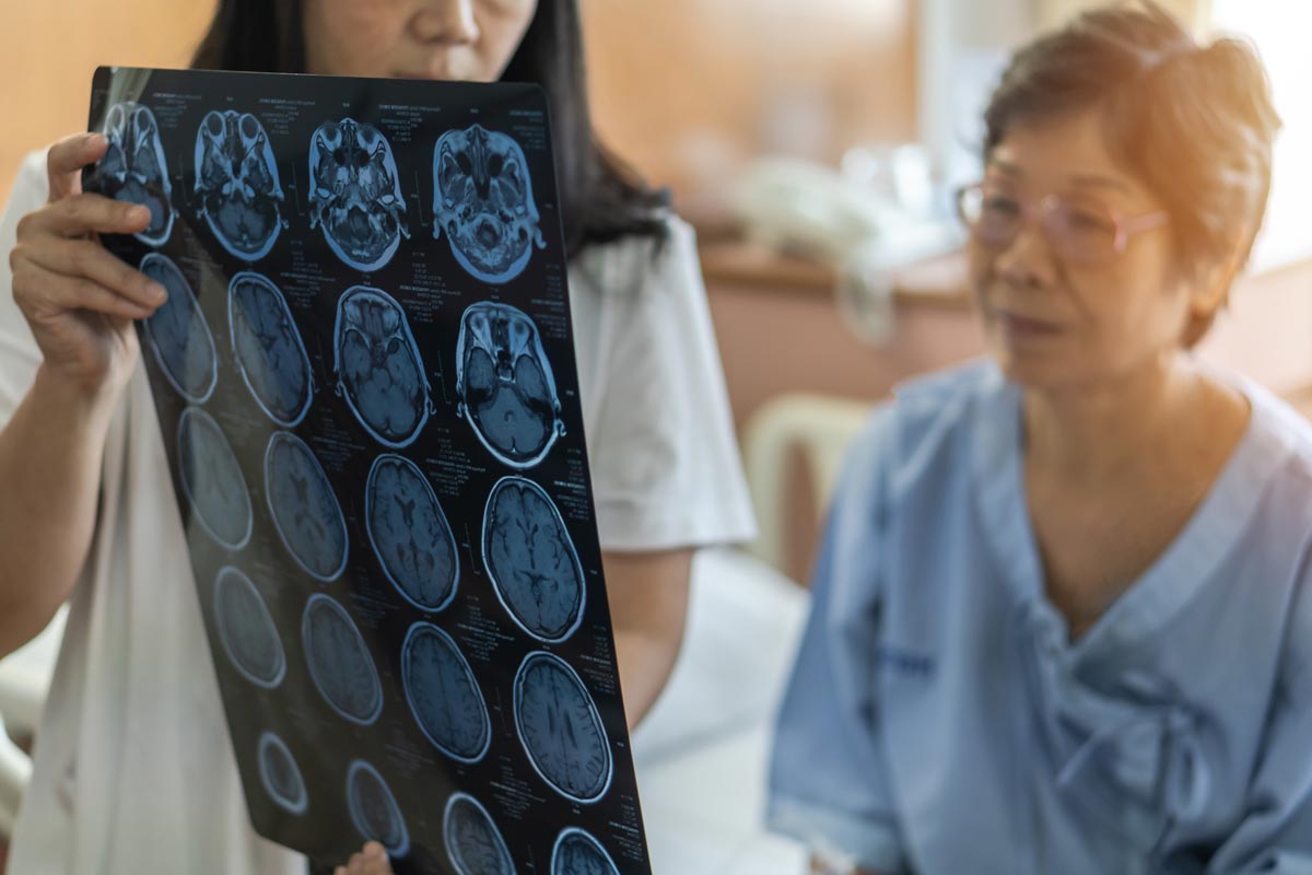 a nurse holds up a brain scan for an elderly woman dressed in a hospital gown