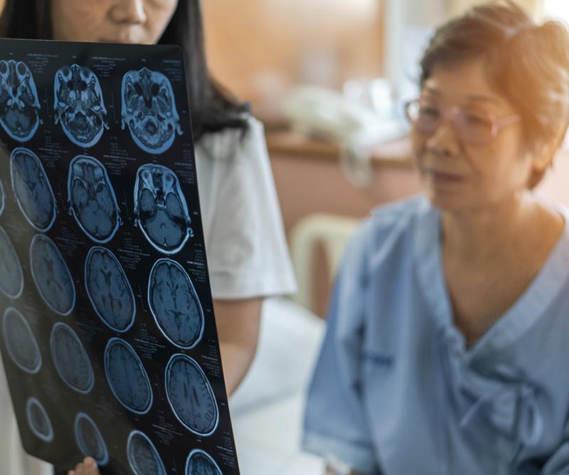 a nurse holds up a brain scan for an elderly woman dressed in a hospital gown