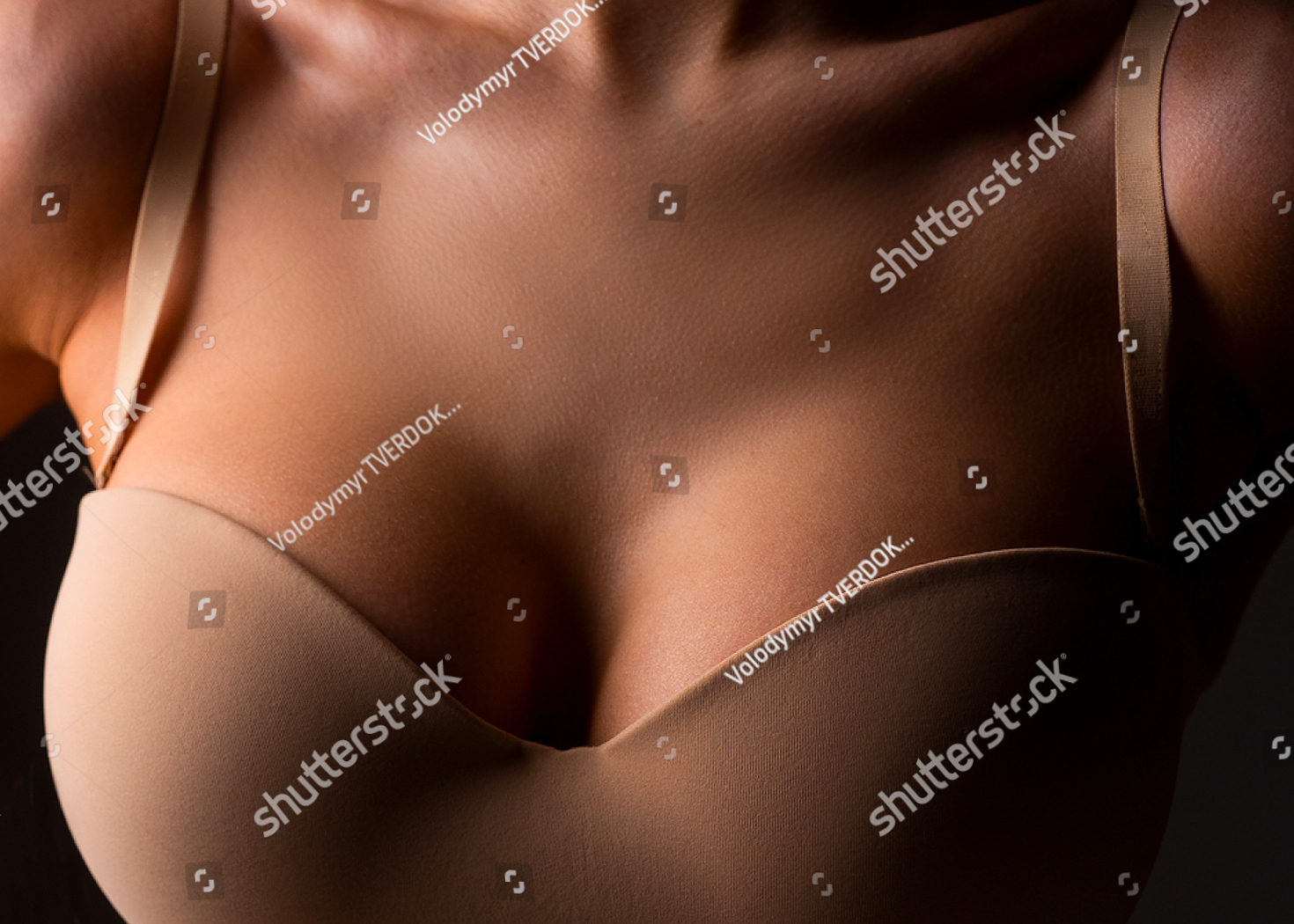 Breast Augmentation