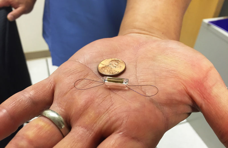 an open hand with a penny and a tiny device wireless monitoring sensor called a CardioMEMS HF System