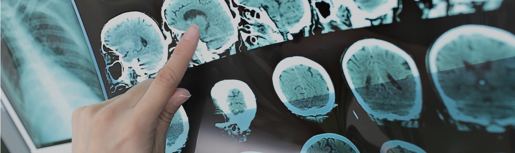 Imaging showing brain activity