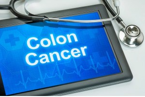 colon-cancer