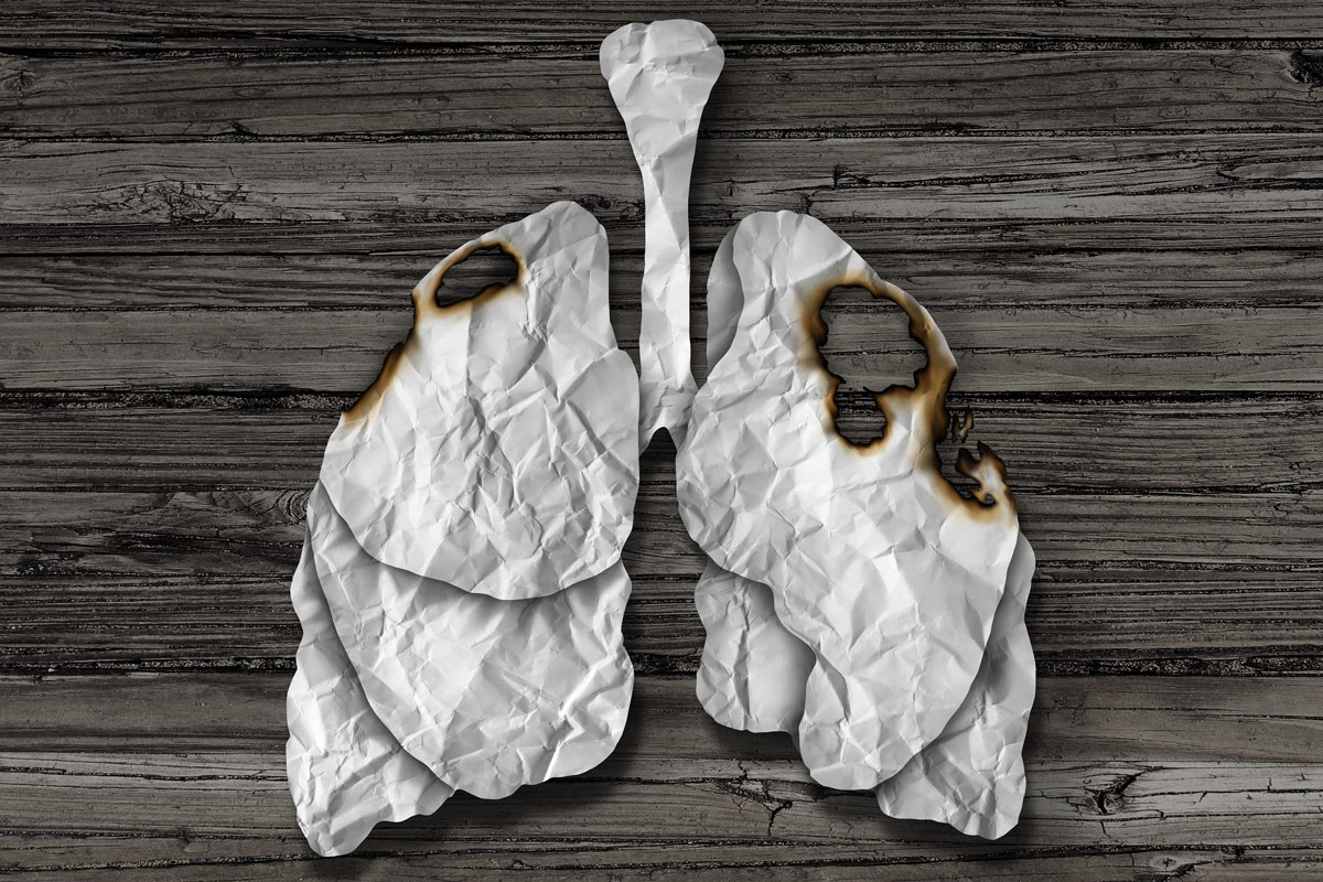 model of a damaged lung