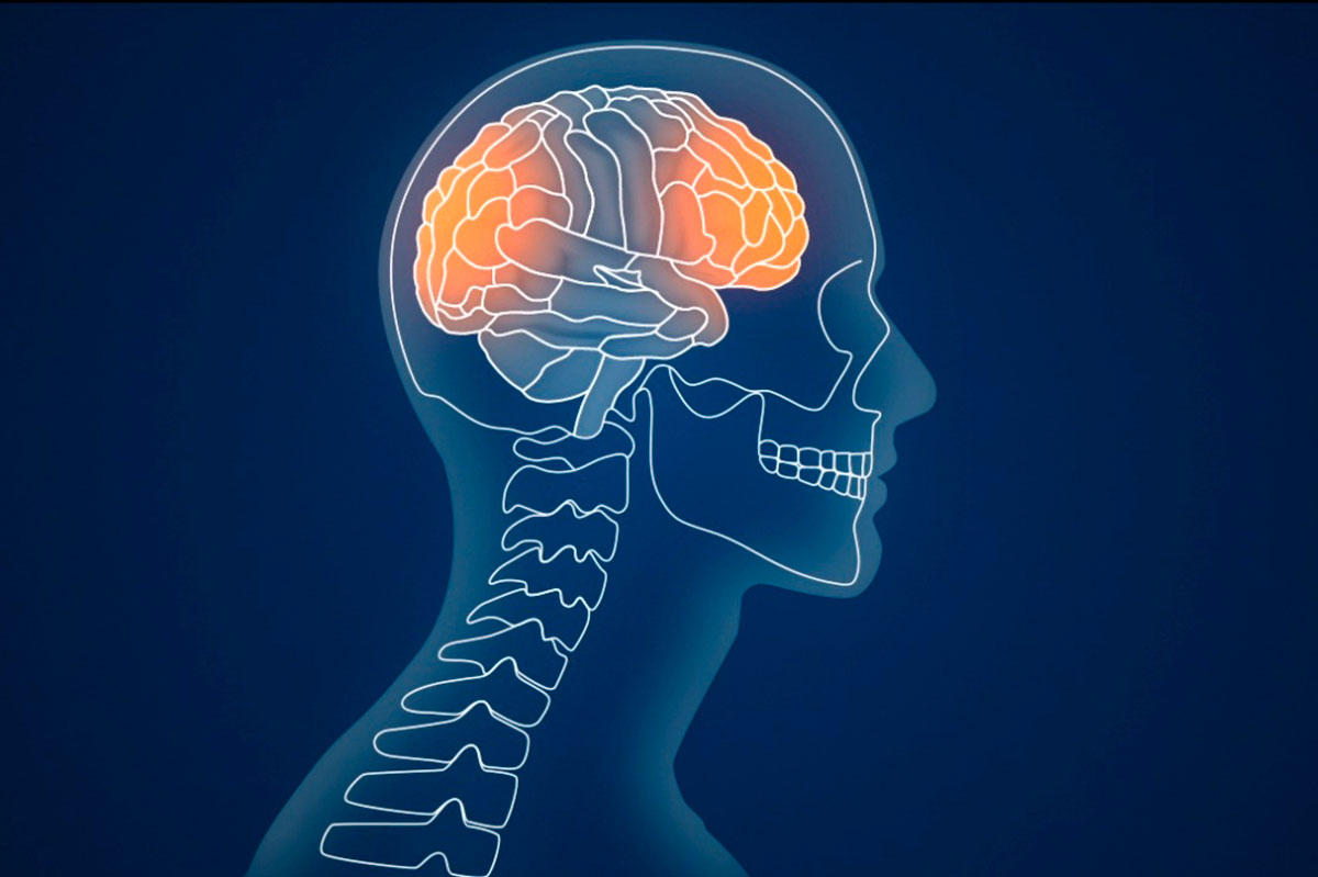 x-ray scan of a brain