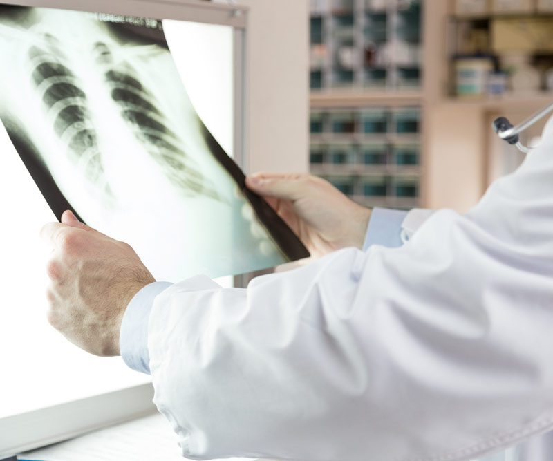 doctor examining x-ray scans of patient