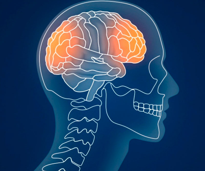 x-ray scan of a brain