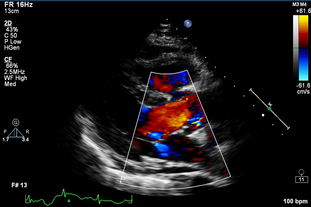 Echocardiography scan