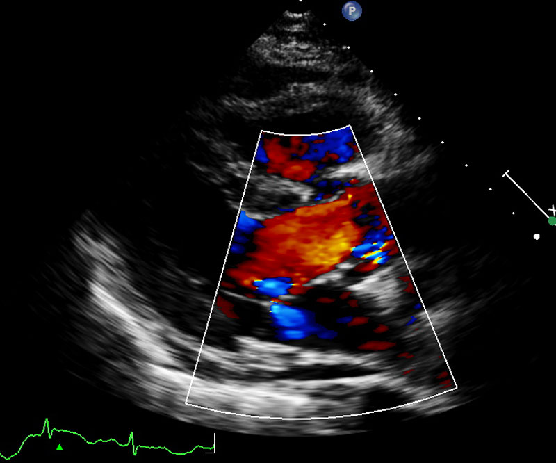 Echocardiography scan