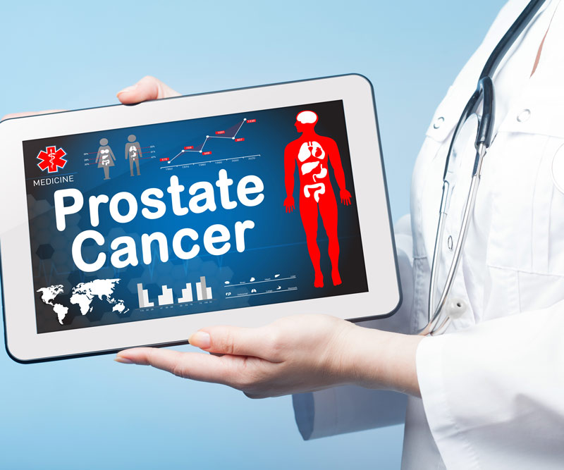 Doctor holding tablet that reads Prostate Cancer