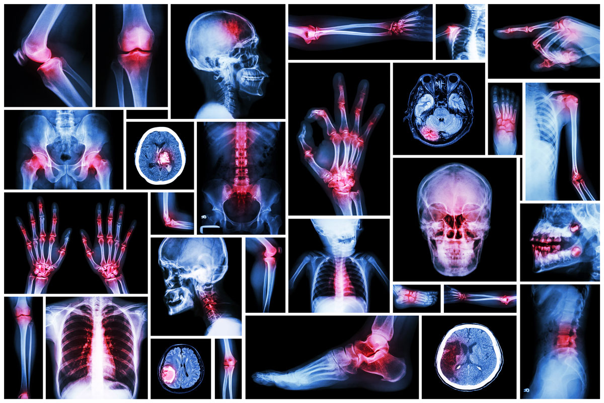 A series of various medical scans