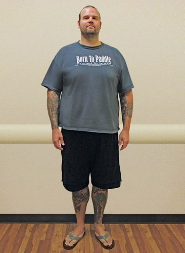 Joseph Blunt before joining the Hawaii Pacific Health 360° Weight Management Center at Pali Momi