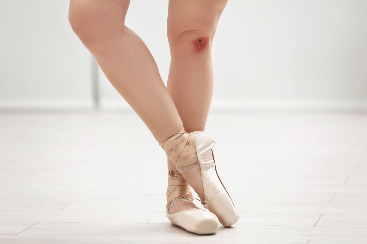 ballerina with a cut on her leg