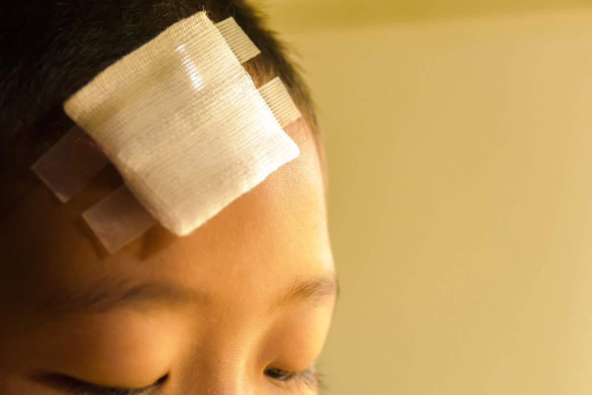 child with a bandage on their forehead