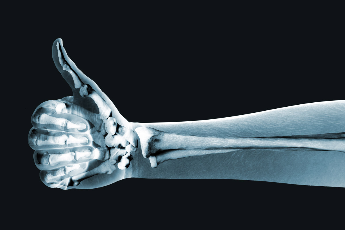 bone scan of an arm