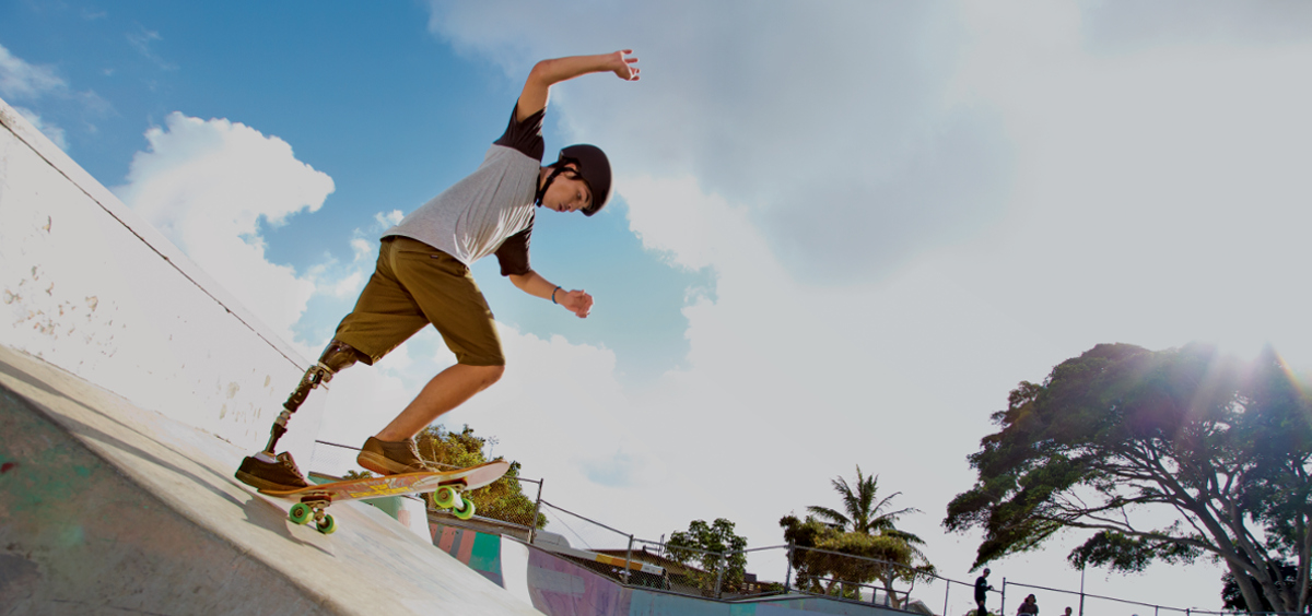 Boy with mechanical leg skateboarding