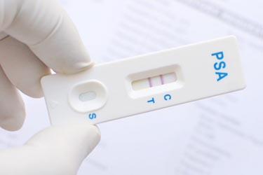 prostate cancer screening report