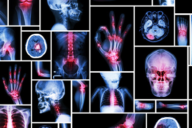 Diagrams of various bone and joints in the body