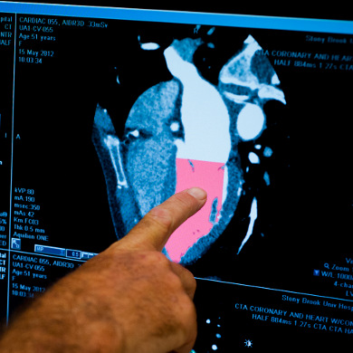 Doctor analyzing an image of a heart