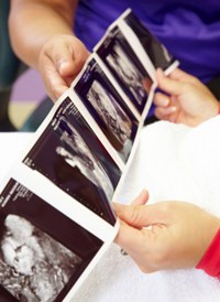 Fetal Diagnostic Center - Imaging Read Out