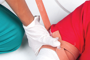 doctor stopping a bleeding